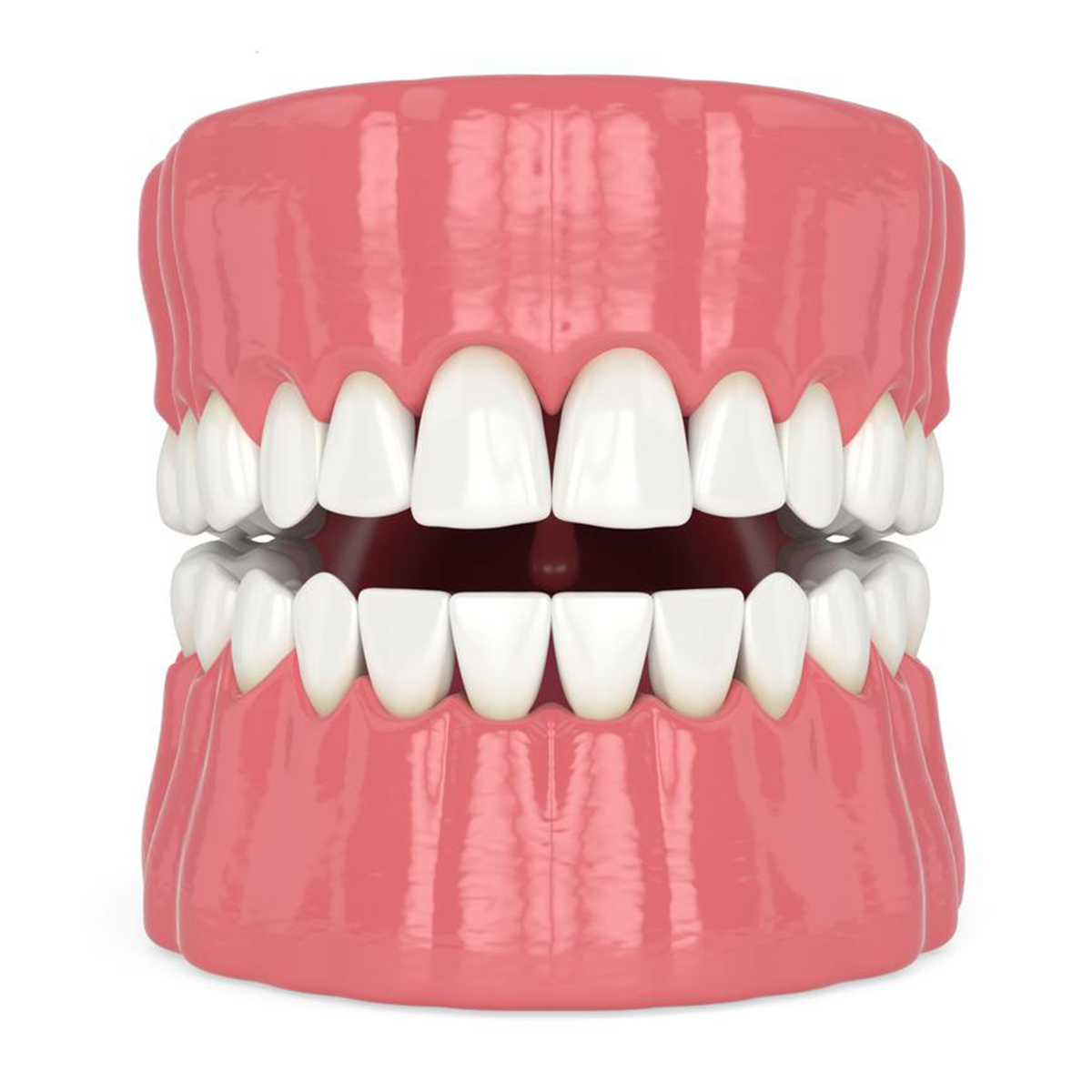 Fractured-Teeth-Restoration-01