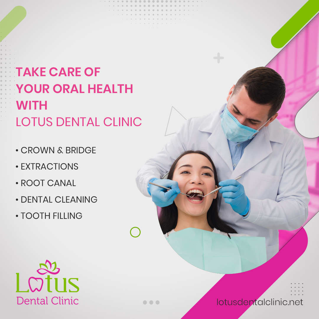 Lotusdentalclinic instagram (6)